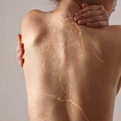 Será que a menopausa é sinônimo de dores no corpo?